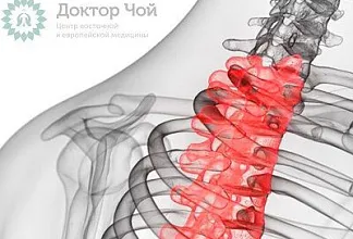 Грыжа грудного отдела позвоночника — симптомы и лечение