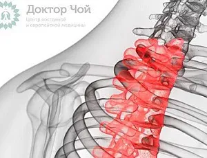 Грыжа грудного отдела позвоночника — симптомы и лечение