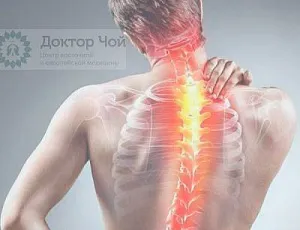 Дорсалгия — симптомы и лечение