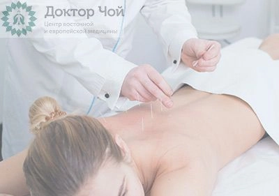 Иглорефлексотерапия спины в Москве